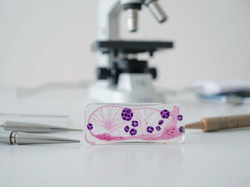 What Does Inflammation in Biopsy Results Indicate?